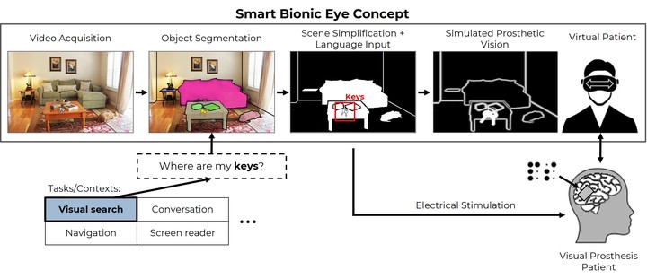 Towards a *Smart Bionic Eye*: AI-powered artificial vision for the treatment of incurable blindness