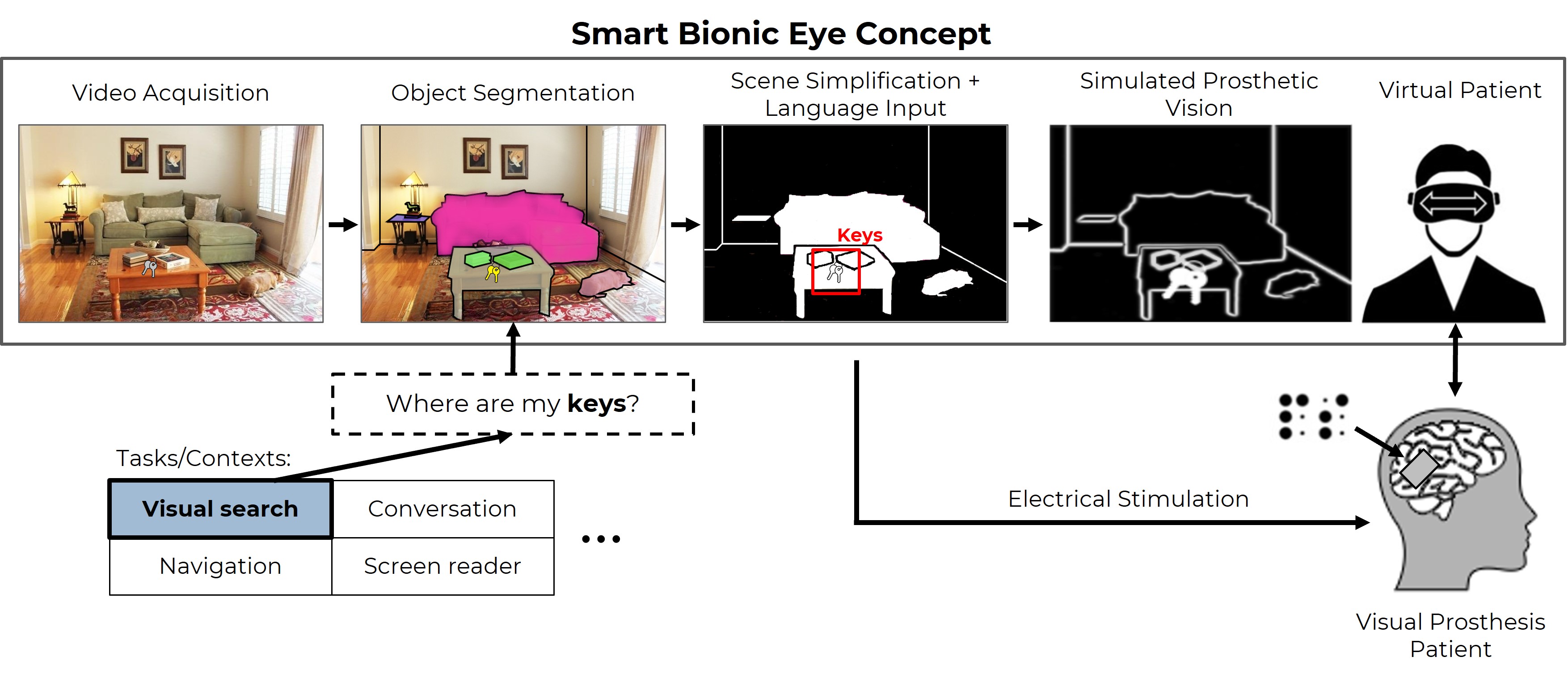 Smart Bionic Eye concept